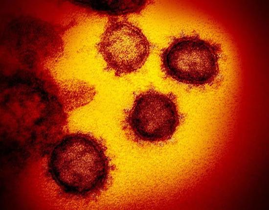  透射显微镜图像：暗黑色圆形物的为新冠病毒。/NIAID-RML